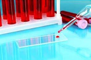 Blood drops for parasites Hemoskania