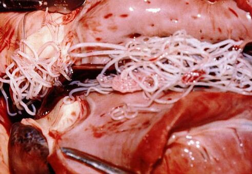 Parasites in the human body