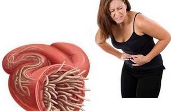 How to remove parasites from the body