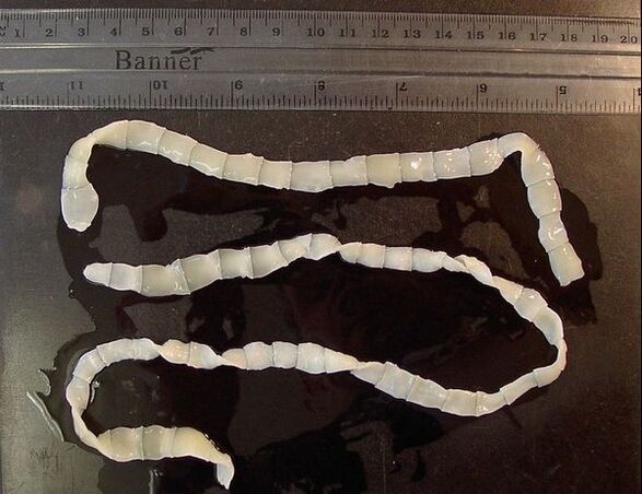 wide tapeworm from the human body