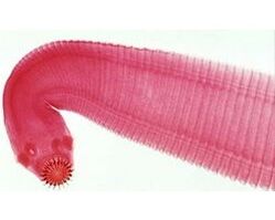worm parasite from the human body