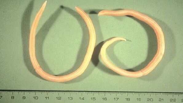 Lumpy worms are worms that manifest as fatigue and cough.