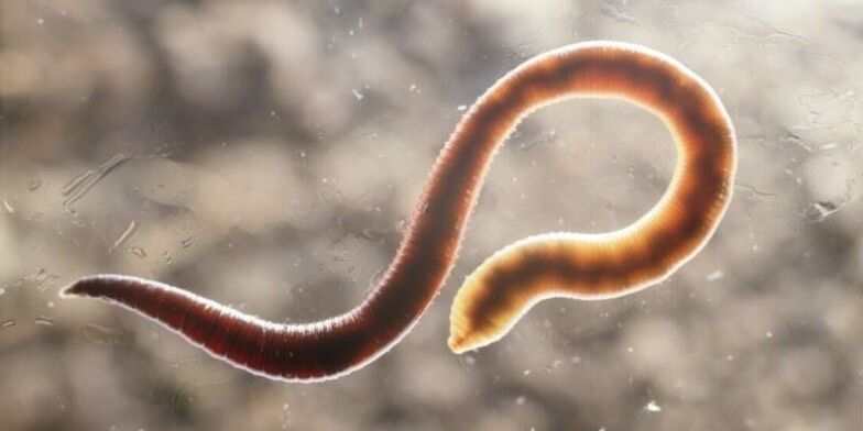 human pinworm