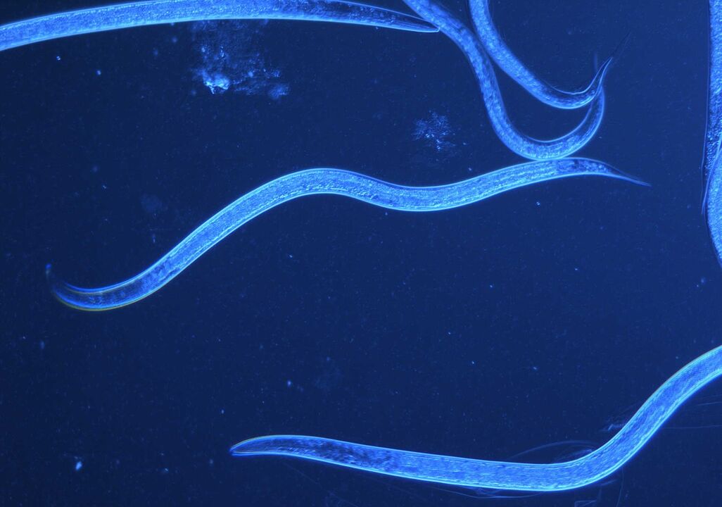 the human whip worm