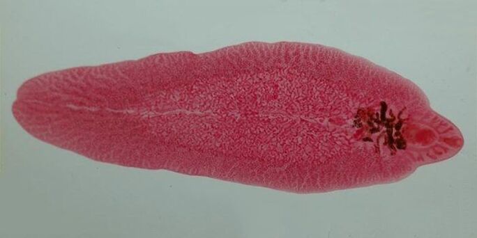 worm in people
