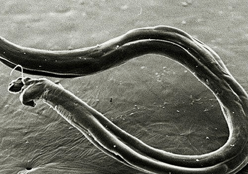 how worms appear in the human body