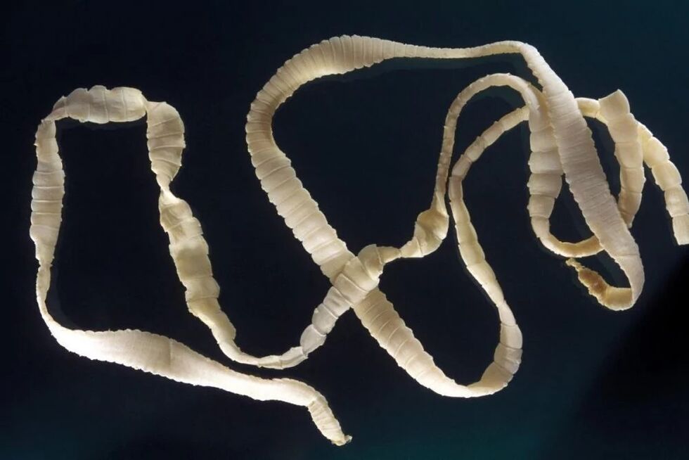 lenteworm, a parasite of the human body