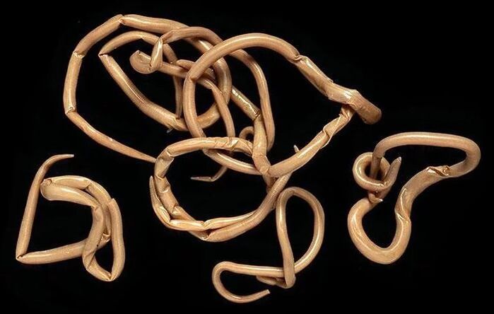 type of parasitic roundworms
